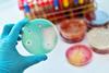 Antimicrobial susceptibility testing in petri dish