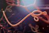 Ebola_shutterstock_210544051_300tb